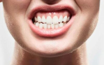 Bruxismo: la enfermedad silenciosa que se puede tratar