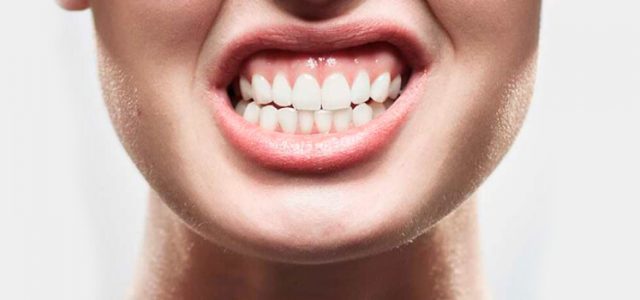Bruxismo: la enfermedad silenciosa que se puede tratar